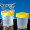 Urinbecher 125 ml mit Schraubdeckel steril (150 Stück)